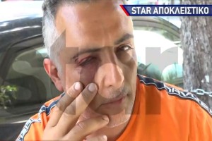 Παλαιό Φάληρο: Ξυλοκόπησαν άγρια και δάγκωσαν ελεγκτή εισιτηρίων σε λεωφορείο - «Με χτυπούσαν στο κεφάλι με κλειδί...» (video)
