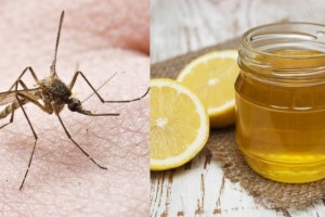 Φλεγμονή από κουνούπι: «Σωτήρας» σου η σπιτική κρέμα από μέλι και λεμόνι - Εξαφάνισε φαγούρα και πληγή
