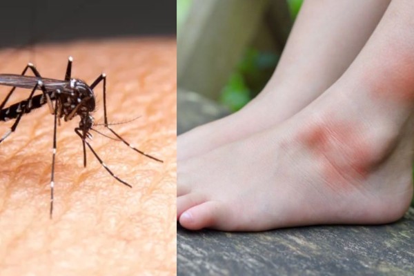 Bye bye κουνούπια: Το κόλπο με το αλουμινόχαρτο και 1 υλικό που θα «μπλοκάρει» κάθε τους είσοδο