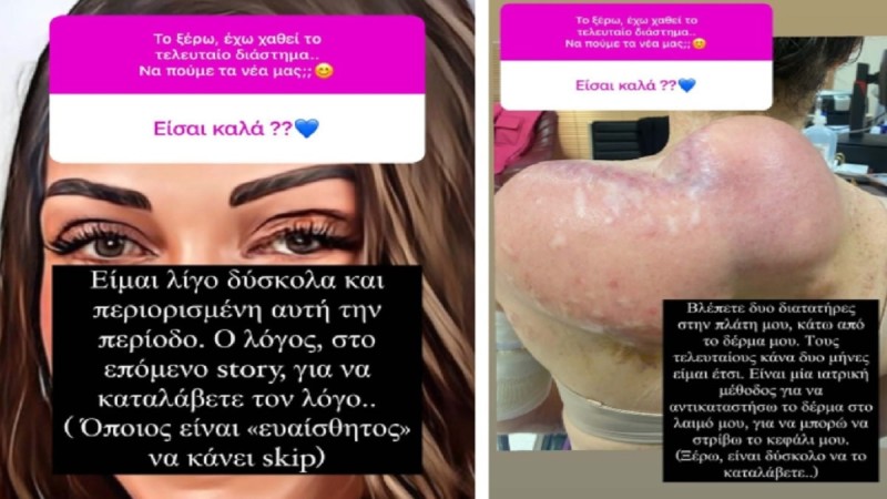 Η σοκαριστική φωτογραφία που δημοσίευσε η Ιωάννα Παλιοσπύρου