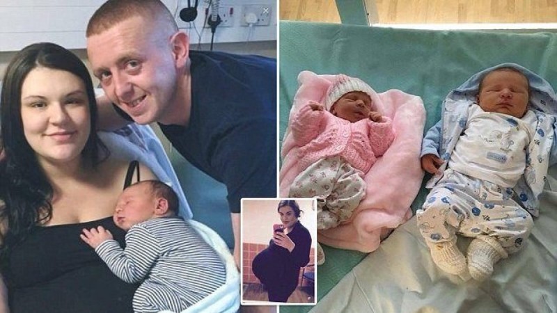 23χρονη έγκυος γέννησε ένα υγιέστατο αλλά «διαφορετικό» μωράκι - Οι γιατροί σοκαρισμένοι δεν μπορούσαν να πιστέψουν αυτό που έβλεπαν (photos)